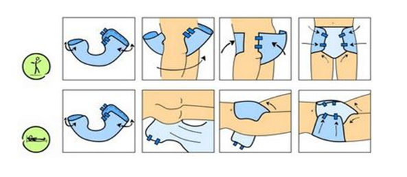 Алгоритм замены подгузника взрослому лежачему больному