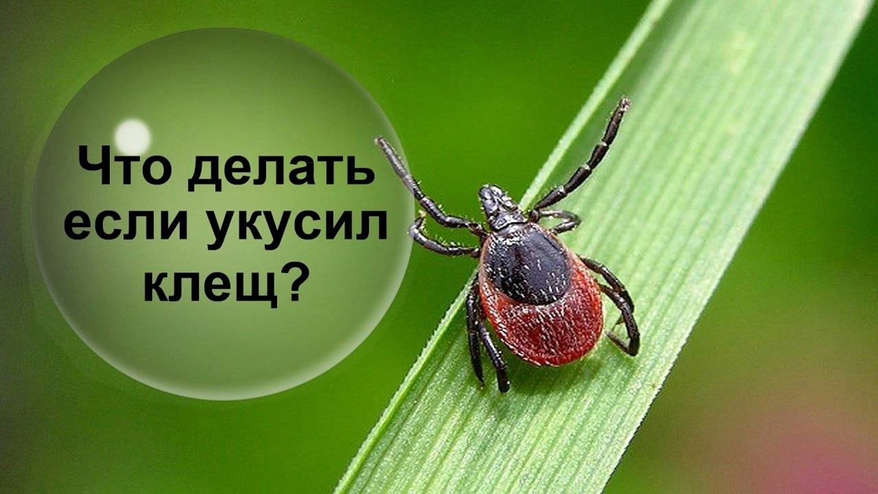 Укусил клещ: что делать?